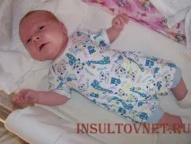 Абсанс епілепсія особливості та симптоми захворювання особливості
