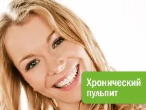 Хронічний пульпіт хронічний