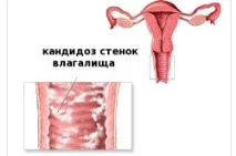 часте