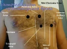 аускультація