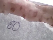 БАКТЕРІАЛЬНА КОЛОНІЗАЦІЯ ІНДОМЕТАЦИН-ІНДУЦЮВАНИХ ВИРАЗОК ТОНКОГО КИШЕЧНИКА ЩУРА - Успіхи тонкого