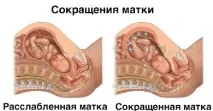 після