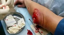причини
