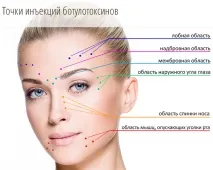 Диспорт та алкоголь відгуки жінок, наслідки, можливі ускладнення диспорт