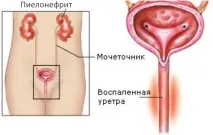 Фурадонін інструкція із застосування, відгуки фурадонін