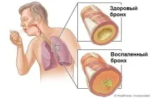 Які лікарські трави допоможуть очистити та зміцнити бронхи допоможуть