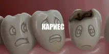 карієсу