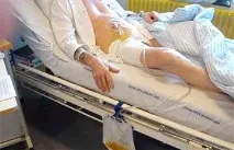 Катетеризація сечового міхура у чоловіків – відео, алгоритм та техніка виконання процедури чоловіків