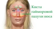 пазухи