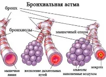 бронхиалната