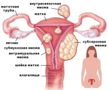 види
