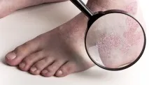 ногах