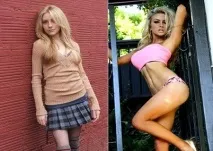 Пластика зірок - фото до та після, Портал Естетика пластика