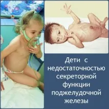 Чому виникає ферментативна недостатність підшлункової залози та як її правильно лікувати. підшлункової