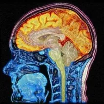 Втрата пам’яті – причини, що покаже мрт при порушеннях пам’яті втрата