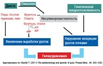 Подагра - мультиморбідна патологія подагра