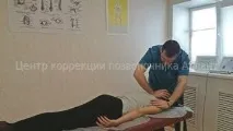 Сколіоз – це не хвороба! сколіозу