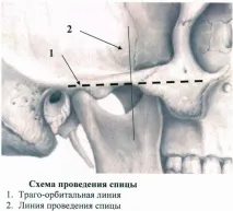 прешлени