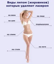 Видалення ліпоми хірургічним шляхом та лазером видалення