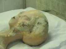 10 псевдо-відкриттів, які вразили науковий світ псевдо-відкриттів