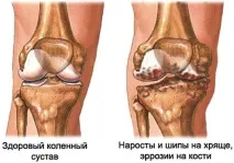 колінного