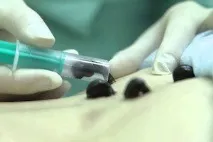 Чим корисна гірудотерапія при остеохондрозі може