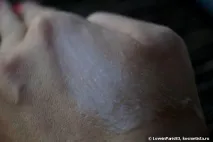 capture