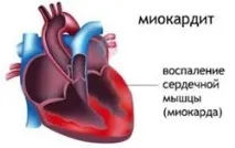 брадикардія