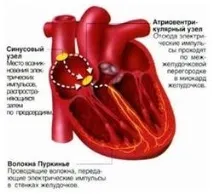 серця