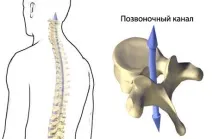 захворювання