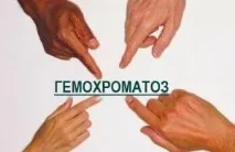 надлишок