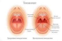 наслідки