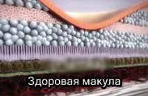 Що таке діабетичний макулярний набряк таке
