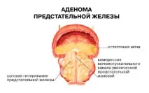 трепетлика