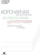 Коронарна ангіографія, вентрикулографія, шунтографія - Меркулов Е вентрикулографія