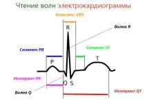Методи профілактики інфаркту міокарда серця інфаркту