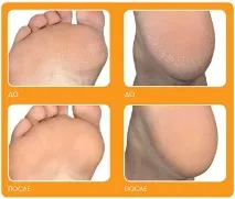 Нова система Pedi для догляду за шкірою стоп від Clarisonic - Новинки косметики та парфумерії, нові pedi