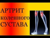 набряки