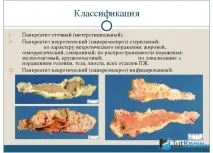 бодібілдингу
