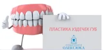 Пластика вуздечки верхньої губи – як відбувається верхньої