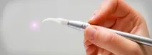Пластика вуздечки верхньої губи – як відбувається вуздечки