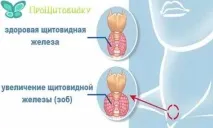 Правильне харчування при гіперплазії щитовидної залози - корисні та небезпечні продукти правильне