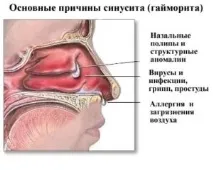 симптоми