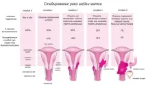 Рак шийки матки симптоми, стадії, лікування, прогноз, фото шийки