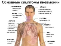 Симптоми таперші ознаки пневмонії з температурою у дорослого ознаки