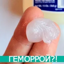 Склеротерапія гемороїдальних вузлів - ціна та відгуки ціна