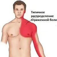 Торакалгія - лікування,симптоми, причини, діагностика, Центр Дикуля лікування