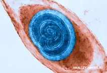 Аналіз визначення антитіл IgG до трихінеллі (anti-Trichinella IgG) у медичній лабораторії - антитіл