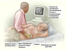 Антифосфоліпідний синдром види, причини, симптоми та лікування види