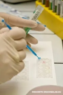 Аналіз на антитіла IgG та IgМ вірусу паротиту, Каталог аналізів медичної лабораторії ЕндомедЛаб (г антитіла